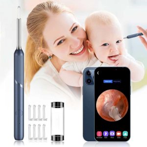 Ear Cleaning Camera Otoscope, Endoscope, 3 in 1 Ear Wax Removal